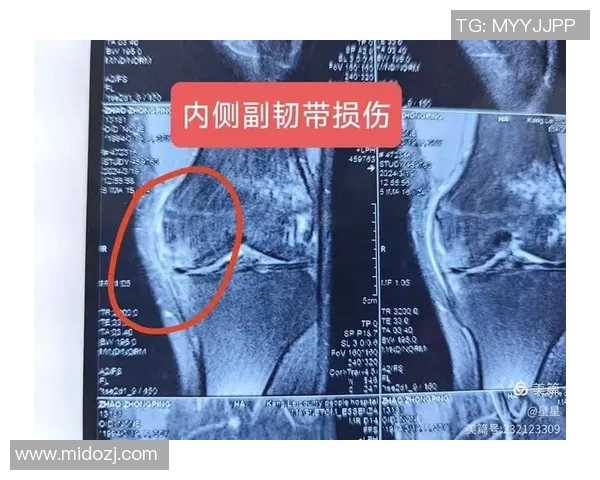 伤情确定!詹姆斯遭遇左膝内侧副韧带二级扭伤 伤情确定!詹姆斯遭遇左膝内侧副韧带二级扭伤